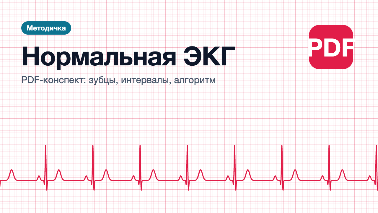 Нормальная ЭКГ